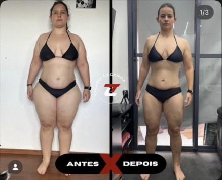 Antes e depois de aluna do LacerdaTEAM