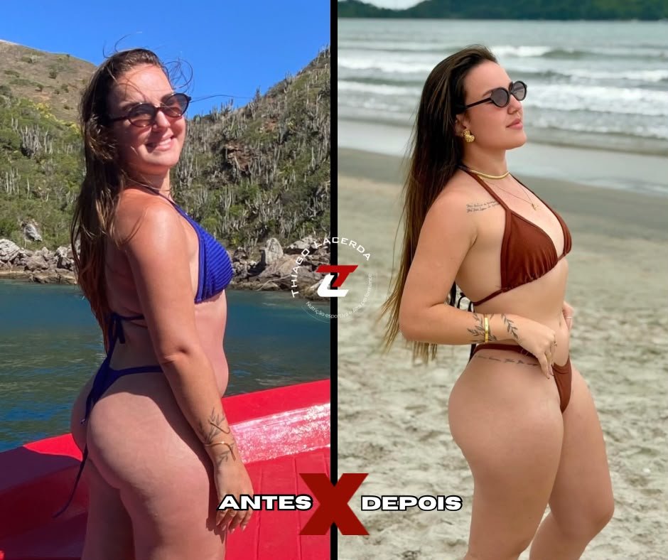Antes e depois de aluna do LacerdaTEAM